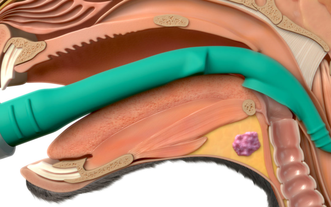 Tubo endotraqueal V-Gel Advanced